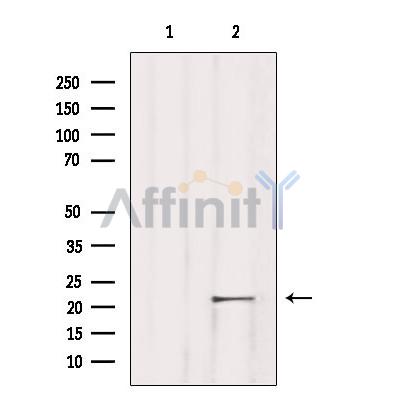Валидация Affinity DF8851 - 20932