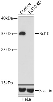 A1106, вестерн-блоттинг, лизаты клеток HeLa (4019)
