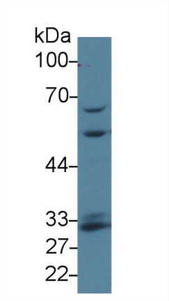 13910