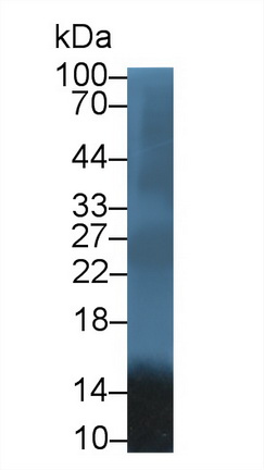 13871