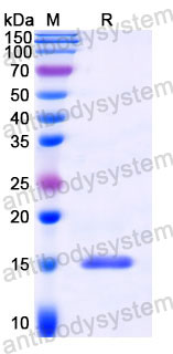 Валидация SDS-PAGE - AntibodySystem RZZ01802
