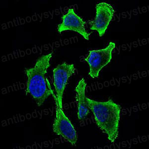 Валидация IF - AntibodySystem RHN93901