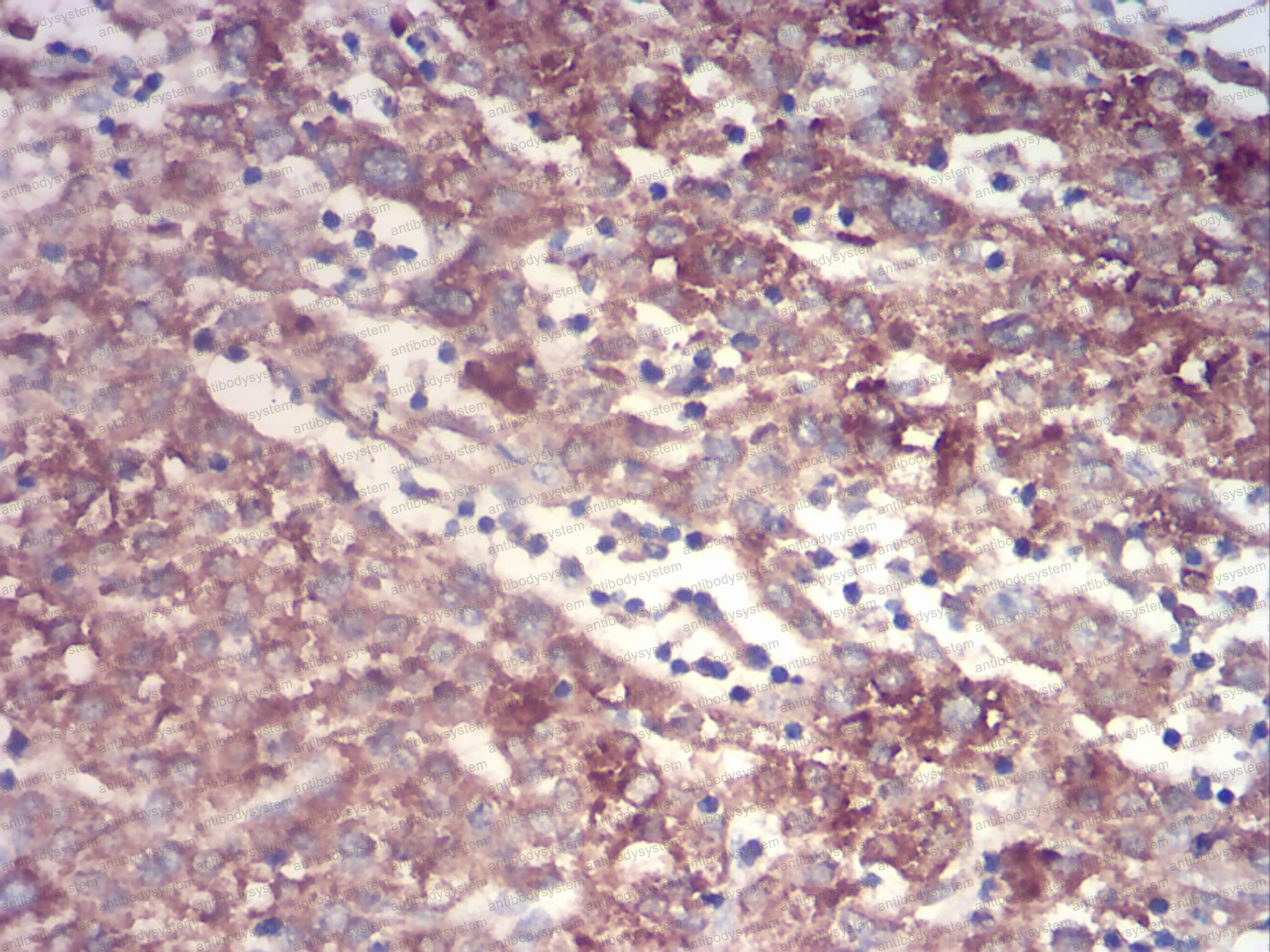 Валидация AntibodySystem RHC01306