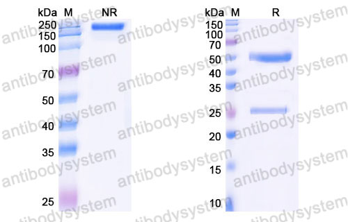 Валидация SDS-PAGE - AntibodySystem FRJ92850