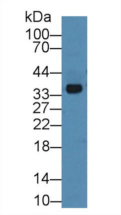 12359
