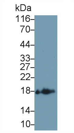 22761