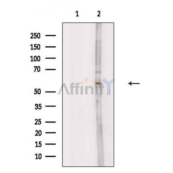 Валидация Affinity AF6844 - 4073