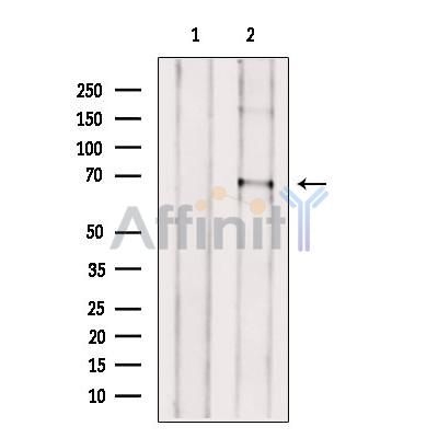 Валидация Affinity DF9156 - 21511