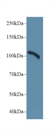 14581