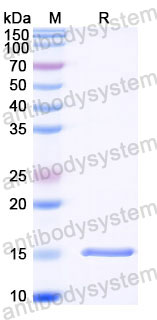 Валидация SDS-PAGE - AntibodySystem RXX05805