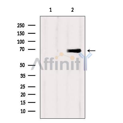 Валидация Affinity AF9061 - 4812