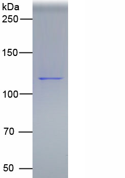 65533