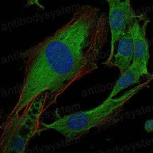 Валидация IF - AntibodySystem RHE47602
