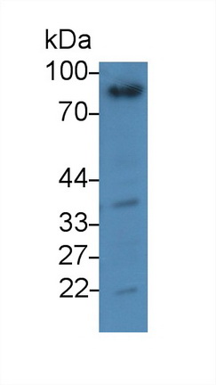 25657