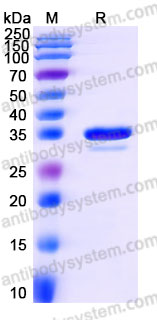 YHF17102, SDS-PAGE