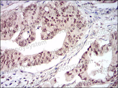 Валидация AntibodySystem RHD69903