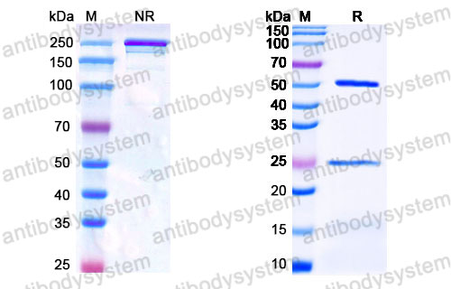 Валидация SDS-PAGE - AntibodySystem FMJ92840