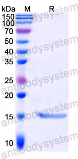 Валидация SDS-PAGE - AntibodySystem RXX52002