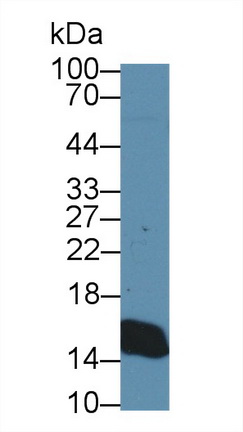17598