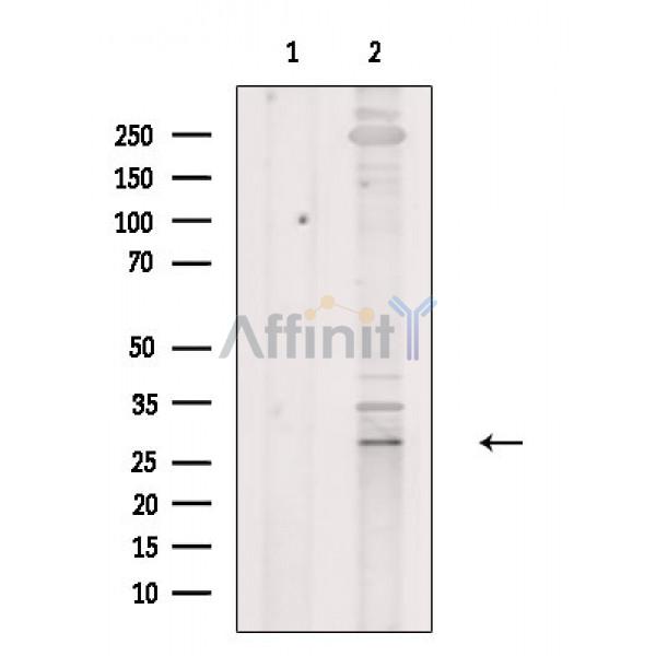 Валидация Affinity DF4147 - 15460