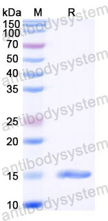 Валидация SDS-PAGE - AntibodySystem RXX05903