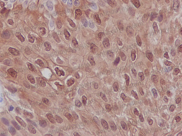 Валидация AntibodySystem RHD68501