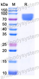 AHC31204, SDS-PAGE