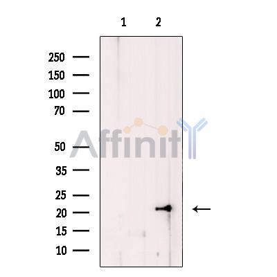 Валидация Affinity DF12068 - 6135