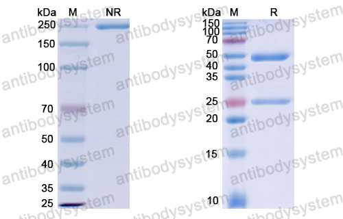 Валидация SDS-PAGE - AntibodySystem DHJ25201