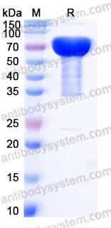 EHJ38603, SDS-PAGE