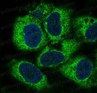 Валидация IF - AntibodySystem RHD87202