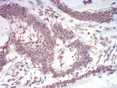 Валидация AntibodySystem RHF98703