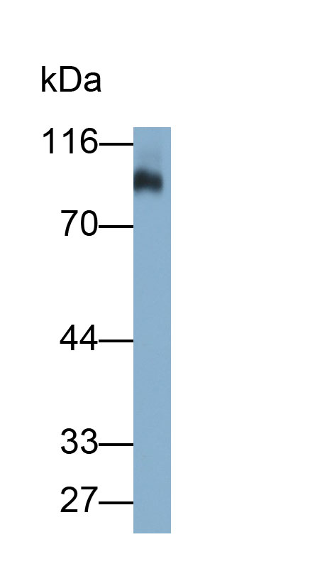 33285