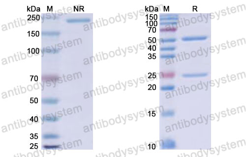 Валидация SDS-PAGE - AntibodySystem DQJ26601