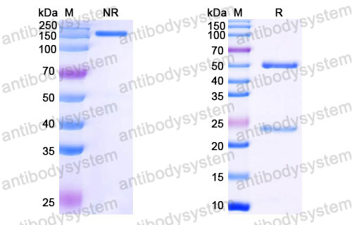 Валидация SDS-PAGE - AntibodySystem FMB96820