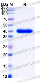 YHG17702, SDS-PAGE