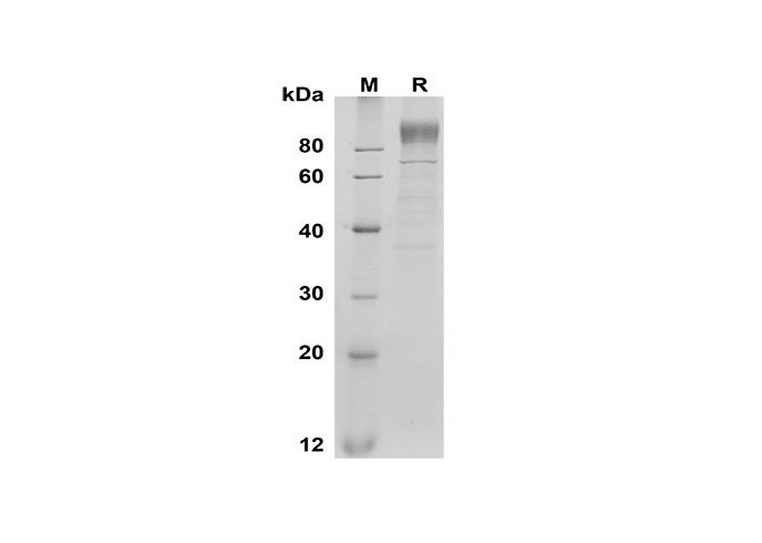 Валидация Elabscience PDMM100175(1135)