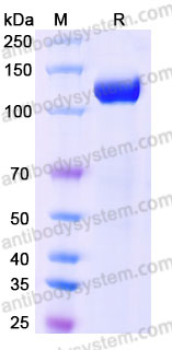 AMD15101, SDS-PAGE