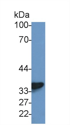 14813