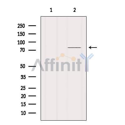 Валидация Affinity DF9018 - 21239