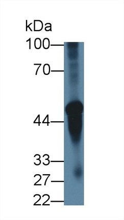 12795