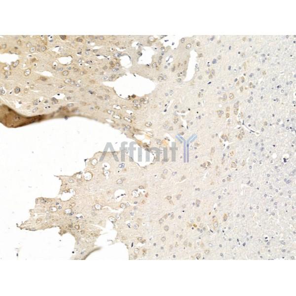 Валидация Affinity DF13581 - 9052