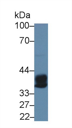 9126