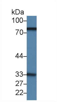 14352