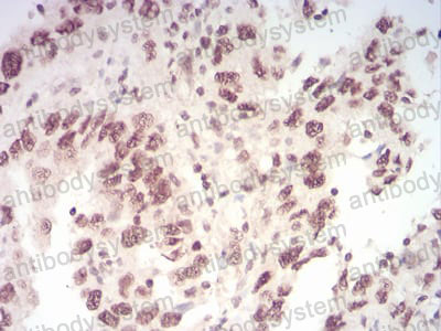 Валидация AntibodySystem RHG96902 (3130)