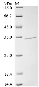 SDS-PAGE