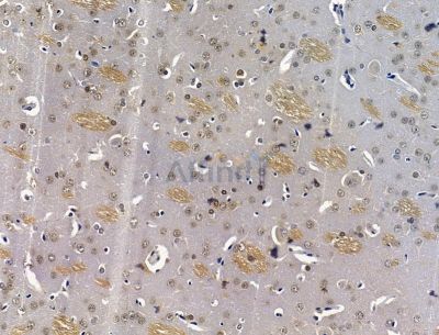 Валидация Affinity DF15387 - 11702