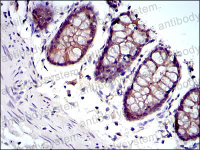 Валидация AntibodySystem RHD07802 (1314)