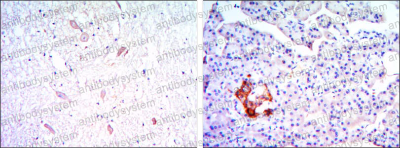 Валидация AntibodySystem RHN91801