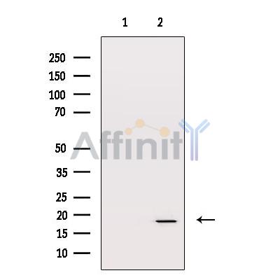 Валидация Affinity AF6003 - 3186